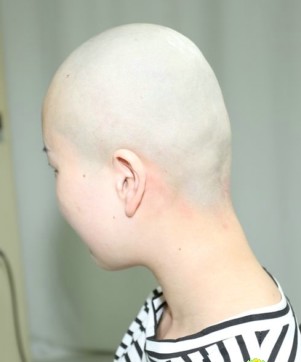 妙龄姑娘剃光头发后更漂亮了-芳飞1225#