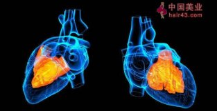 10种最常用的心脏检查项目，哪一项适合自己？专家说的清清楚楚！