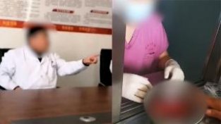 辽宁一女子输尿管结石请铁岭专家主刀，左肾却被摘除，卫生局回应