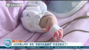 100天经心呵护 淮安患有“脊髓新肌萎缩症”的宝宝能动了