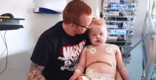不明原因肝炎：英国一名3岁患儿生命垂危，已被移植其父亲的肝脏