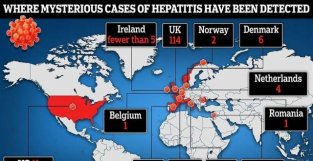 已有12个国家出现不明病因儿童肝炎，10人需肝移植