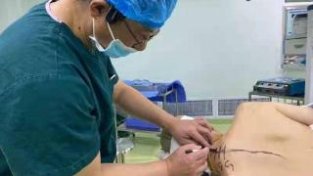 昆医大附一院采用脊髓电刺机技术让“昏M”病人被“唤醒”