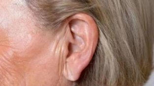 耳垂有折痕是死亡征兆？身体符合5种异常，警惕猝死或降临