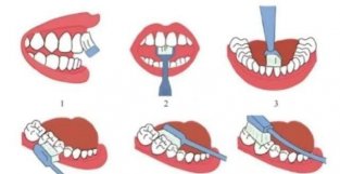 孕期出现牙痛口臭怎么办？牙科护士：孕妈护牙三大宝，摆TUO牙痛！