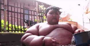 印尼男孩体重400斤创纪录，减掉186斤后，让人不敢认