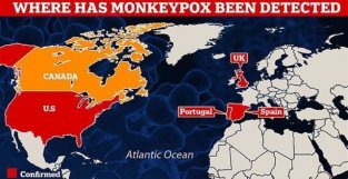 猴痘疫请仍在蔓延，瑞典发现首例确诊病例