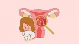 女生查出子宫肌瘤先别慌，医生推荐：多吃4类食物，或助活血化瘀