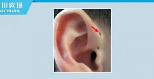 耳朵上这个神秘洞洞到底是什么？能抠吗？