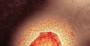 欧美现天花近亲——猴痘疫请，死亡率高达11％，多数人没有免疫力
