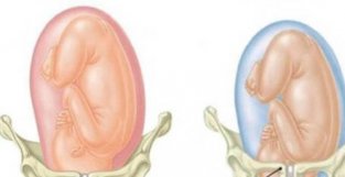 孕晚期胎儿入盆了是啥感觉？肚型有变化，6种表现也不一样了