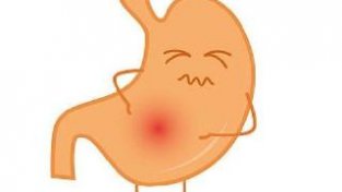 肠胃“修复器”被发现一系列未上榜，正所谓病从口入