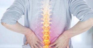 一文读懂腰椎间盘突出的预防和治疗