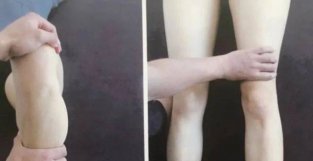 盘点10种膝关节理疗手法，解锁瑜伽教学者常用技术！