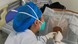 北京地坛医院艾滋病专家火眼金睛辨识伪装隐球菌病