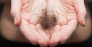 过亿人“秃”遇救星！FDA批准首个斑秃系统疗法，可恢复80％头发生长
