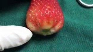医生用草莓模拟子宫做人流，当切开草莓后，你还敢做人流吗