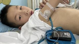宁德9岁男童患重度糖尿病酮症酸中毒 这家医院成功应用这个技术化险为夷