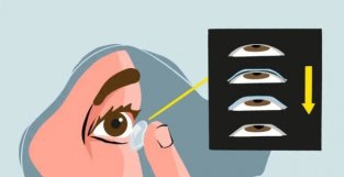 “OK镜”会损伤角膜，这是真的吗？