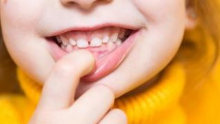 容貌焦虑“卷”到牙齿，暑期儿童口腔矫正一号难求！提醒：不少孩子干预超前