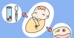 “试管婴儿”是高龄孕育的“救命稻草”？做试管到底有没有年龄限制？