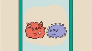 HPV阳新就是宫颈癌？这些常识要了解