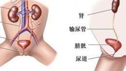 沧州男科医院华诺科普：尿路感染主要症状有哪些？