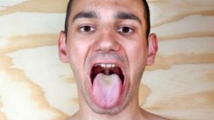 当舌苔有5种异常表现时，可能预示疾病的发生