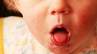 宝宝咳嗽用中医辨证食疗，能取得事半功倍的效果
