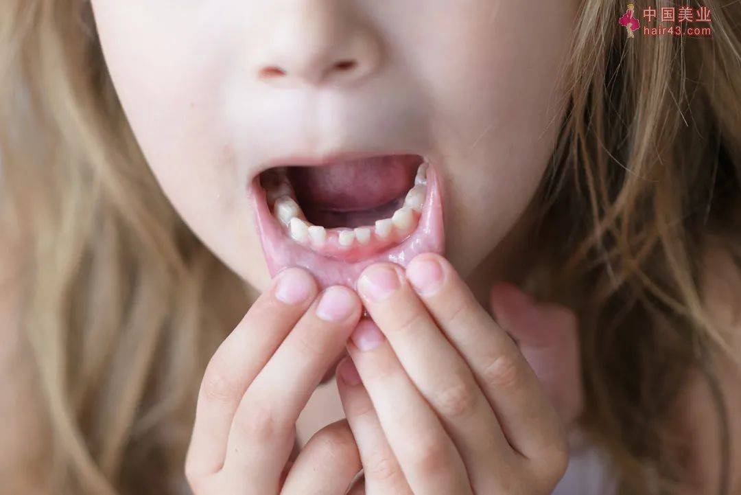 别等牙烂了才后悔！怎么保护牙齿？专家的建议是……