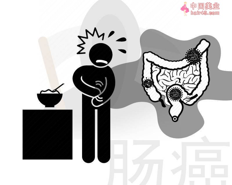 为何广东人饮食清淡，大肠癌发病率却非常高？医生指出3点原因！