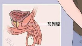 男科专家张志杰主任医生：天气冷会导致前列腺炎加重吗？