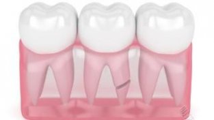 生活中做好5点有效防治牙本质敏感症，建议知晓