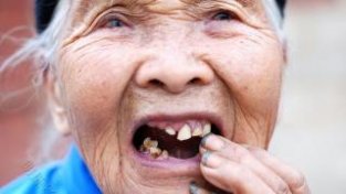 老人保护牙齿，3个方法不能少，建议知晓
