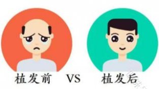 惠州治疗植发权威医院排行：麦穗植发告诉你植发靠谱吗？