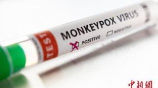 英国研究：猴痘病毒在出现症状前4天就可传播