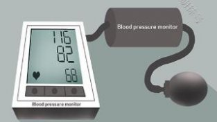 关于在家量血压，这些问题也是大家常关注的，建议学习下