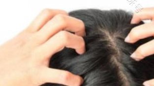 专家解答：头发TUO落跟脾胃不好有关系吗？