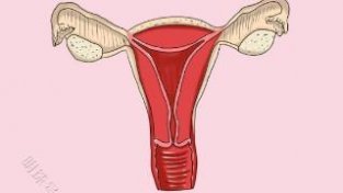 子宫内膜也能“长歪”?了解一下这是什么病
