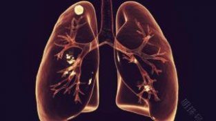肺健康百病消，养肺清肺有哪些方法？建议参考