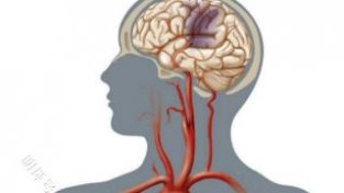 日常增强脑部供血，该怎么做呢？建议参考下