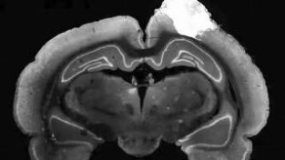 植入鼠脑的人类神经元对视觉刺机产生反应
